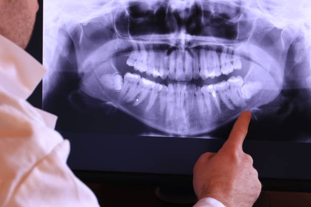 Best Emergency Dental Clinic in RI